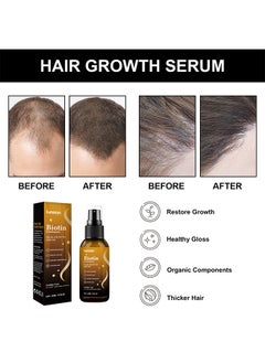 LUNOON Biotin Prcmium Hair Growth Serum - Hair Essential Spray, Biotin Thickening Herbal Serum, Anti Hair Loss Serum For Hair Growth And Hair Loss, Hair Regrowth For Thicker Longer Fuller Hair  - Image 2