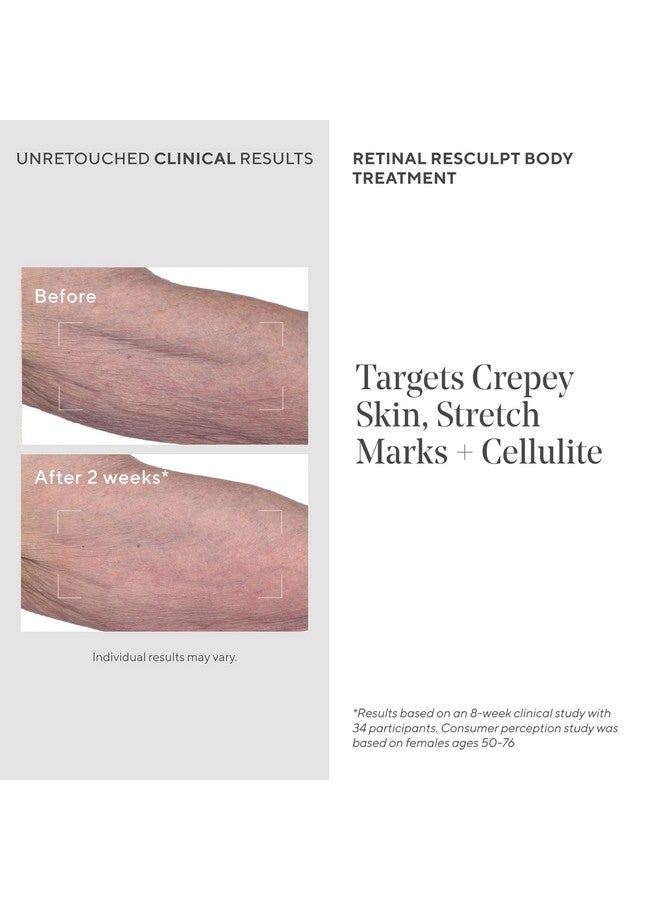Murad Retinal ReSculpt Body Treatment - Retinal Body Cream to Target Cellulite and Stretch Marks - Lifts, Firms, and Tightens Sagging, Crepey Skin, 5.0 Fl Oz - Image 3