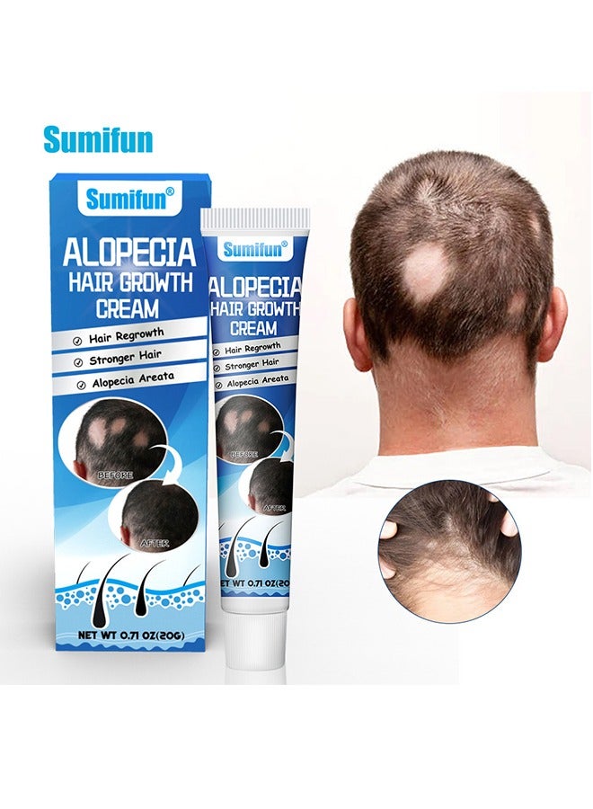 Sumifun Alopecia Hair Growth Cream - for Promote Men's Hair Growth,Prevent Hair Loss,Care for Hair 20g - Image 1