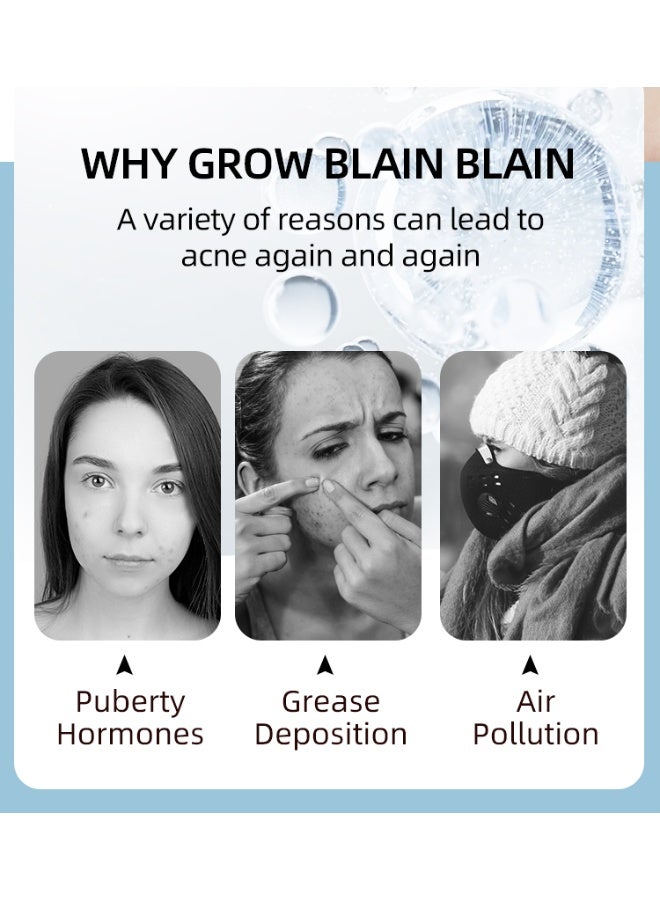 موويام حمض الساليسيليك سالفيا ميلتيروزا جل لإزالة حب الشباب 20 جرام علاج سريع المفعول لحب الشباب في الوجه يفتح لون علامات حب الشباب يزيل حب الشباب ويقلص المسام إزالة حب الشباب بسرعة في 12 ساعة لرؤية النتائج - Image 5