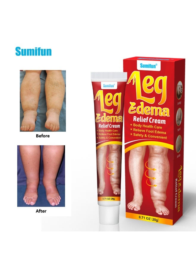 Sumifun Leg Edema Relief Cream-3 Pcs,Relieve foot Edema,Safety & Convenient - Image 2