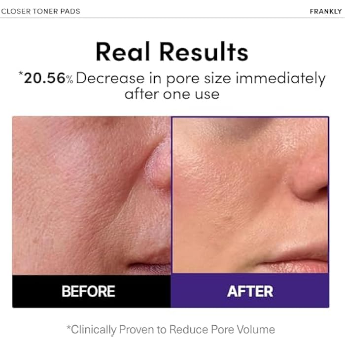 FRANKLY Pore Closer Toner Pads l Rice Jelly Pads with 9 Peptides, Vegan Collagen, Rice Extract l Pore Minimizer l Hydrating for All Skin Types l Korean Skin Care | 70 Count - Image 2