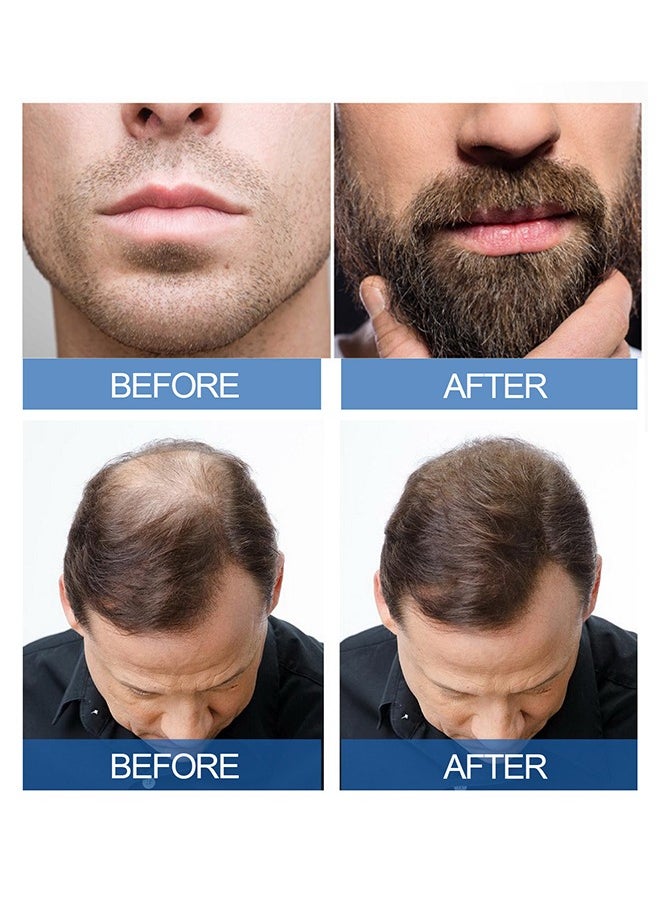 East Moon - Hair Strength Treatment - Extra Strength For Men, Minoxidil 5% For Promote Men's Hair And Beard Growth, Prevent Hair Loss, Care For Hair - Image 1