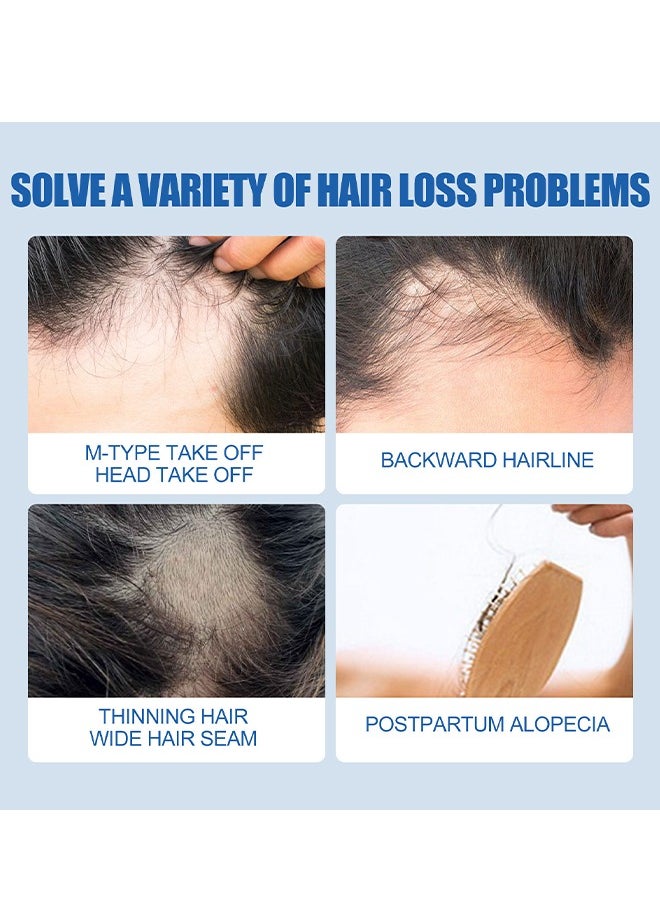 East Moon - Hair Strength Treatment - Extra Strength For Men, Minoxidil 5% For Promote Men's Hair And Beard Growth, Prevent Hair Loss, Care For Hair - Image 1