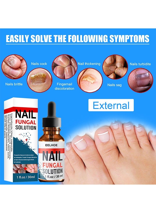 EELHOE Nail Fungal Solution,Fungal Nail Treatment For Toe Nail And Fingernails- Repair Solution For Thick/Broken/Discolored Nails-Renews Damaged Cracked Ingrown Toenail 30ml - Image 2