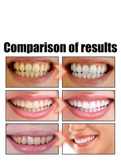 SP Sp-6 Ultra Whitening Toothpaste, Sp-6 Probiotics Whitening Toothpaste, MS DRWIKEY Probiotics Bright White Toothpaste, Msdrwikey Sp-6 Toothpaste Oral Health Management, Fresh Breath (Red)  - Image 5