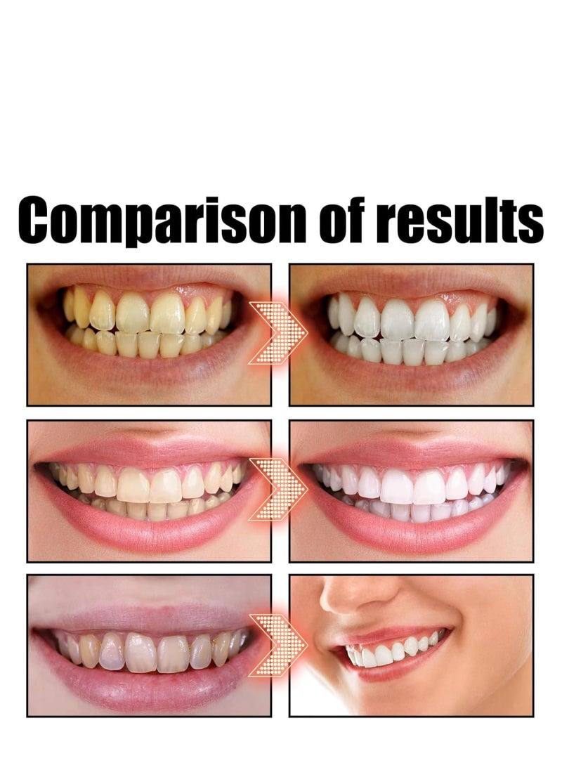 SP - Sp-6 Ultra Whitening Toothpaste, Sp-6 Probiotics Whitening Toothpaste, MS DRWIKEY Probiotics Bright White Toothpaste, Msdrwikey Sp-6 Toothpaste Oral Health Management, Fresh Breath (Red) - Image 1