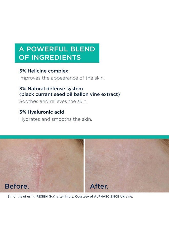 ALPHASCIENCE REGEN [Hx] - Helps Improve Appearance of Skin and Look of Scars - Moisturizing - Normal & Sensitive Skin Types - Paraben-free, Fragrance-free, Alcohol-free, 30 ml/1 fl oz - Image 5