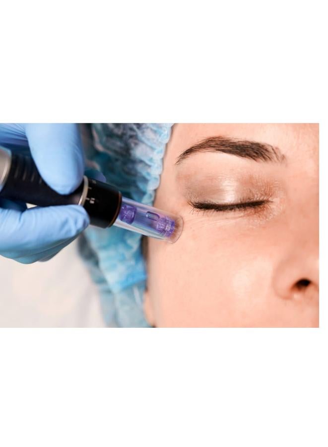 مكم Mesotherapy Out Contour from the Spanish company MCCM 10 mm vial for external use session every two weeks or every 3 weeks Dark circles and puffiness under the eyes may make you look tired, unhealthy, and prematurely aged. The active ingredients in MCCM Out Contour formula are specifically formulated to reduce and prevent these problems. It enhances skin firmness, increases hydration, and reduces wrinkles in the sensitive area around the eyes. It is an ideal choice to get the most out of collagen production stimulation therapy Strengthens blood vessels and microcirculation. Fights free radicals. Removes fluid buildup. At Quality Beauty, we recommend this product for eye and facial treatments. What are the effects of using this product from MCCM Out Contour Cocktail? Reduces the appearance of dark circles Reduce eye puffiness Tightens the eye contour - Image 1
