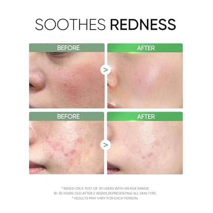 SKINTIFIC Mugwort Clay Stick Mask for Face, Mud Masks with Centella, Salicylic Acid, Gentle Exfoliation, Vegan Korean Skincare Wash-Off Facial Mask for Sensitive Skin - Image 4