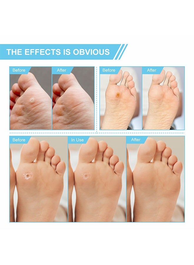 Elaimei Wart Remover Pads, Corns Plaster Powerful Wart Removal Warts on Feet, Toes, and Hands, Self-Adhesive Design Rapid Results Comfortable, Foot Care 24pads  - Image 4