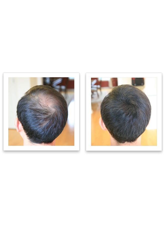 Caboki Hair Loss Concealer, All-Natural Hair Building Fiber. Make Thin Hair Look 10X Fuller Instantly. Eliminate the Appearance of Bald Spot and Thinning Hair (30G, 90-Day Supply). Black