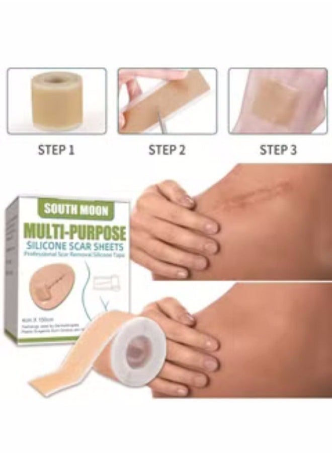SOUTH MOON Silicone Scar Patch Fade Scars Efficient Cosmetic Scar Removal for Cesarean Section Burn Scars and Other Scars Left Behind Gel Painless Tape Roll (4cm X 1.5m)  - Image 1
