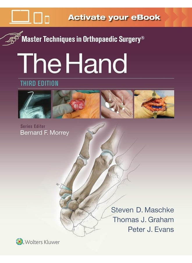 Master Techniques in Orthopaedic Surgery: The Hand 