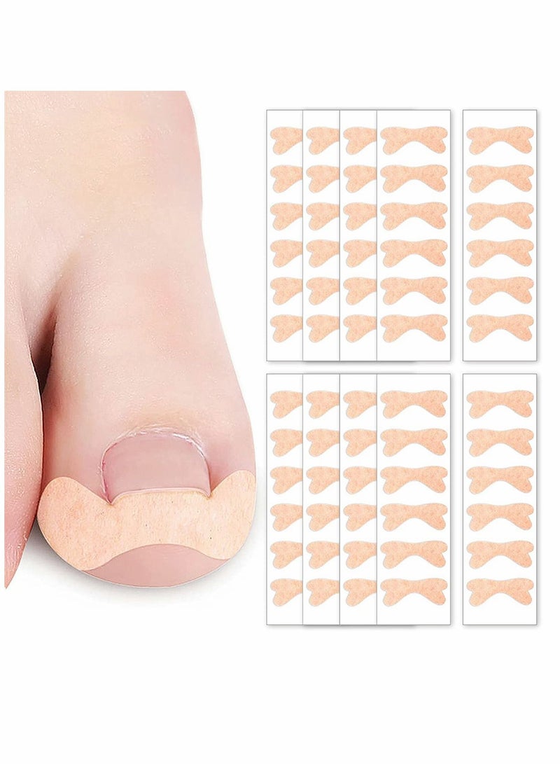 سيوسي ملصق تصحيح أظافر القدم إنغرون ، لاصقة أظافر القدم اللاصقة ، ملصق مصحح معالجة الأظافر المرن ، أدوات احترافية للعناية بالقدم ، للرجال تحافظ على صحة الأظافر (120 قطعة) - Image 1