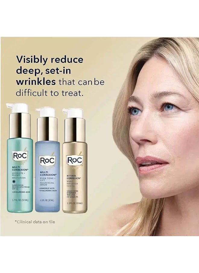 RoC - Multi Correxion Even Tone + Lift Resurfacing Serum, Facial Repair Essence, Gentle Removal of Dull Uneven Skin, Fade Facial Fine Lines Essence - 30ML - Image 1