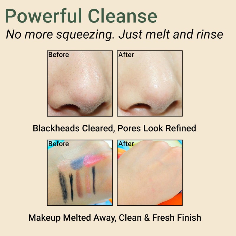 CELDYQUE Pore Purifying Cleansing Oil â€“ Korean Face Wash with Centella, Tea Tree, Green Tea & LHA â€“ Gentle Makeup Remover for Sensitive, Acne-Prone Skin, Deep Pore Cleanser, 6.76 fl oz - Image 5