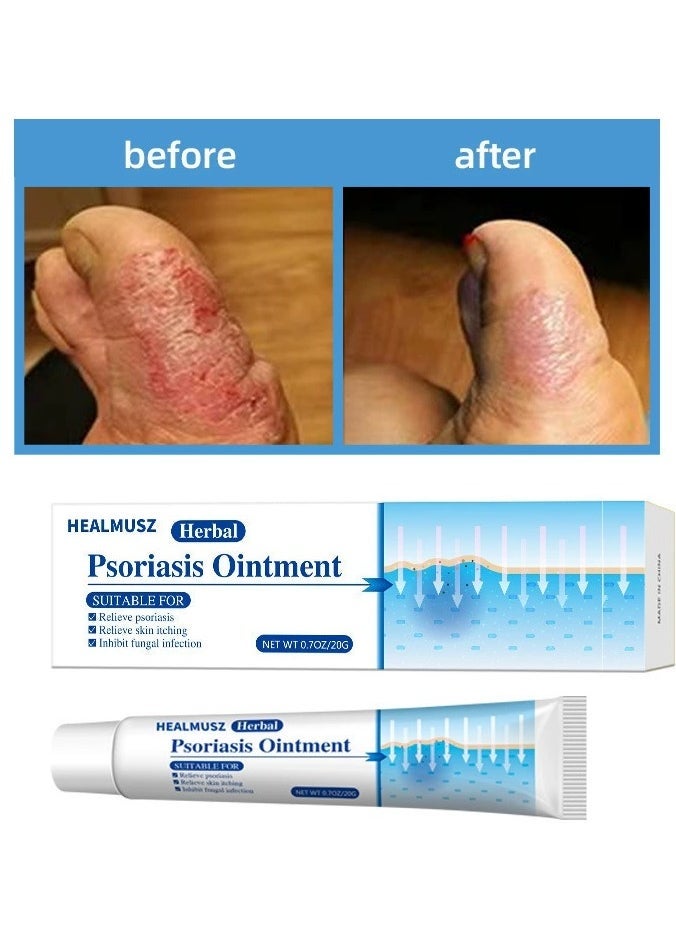 HEALMUSZ كريم الصدفية 2 عبوة، مرهم خارجي للبشرة، مرهم مضاد للبكتيريا 20غ*2 - Image 5