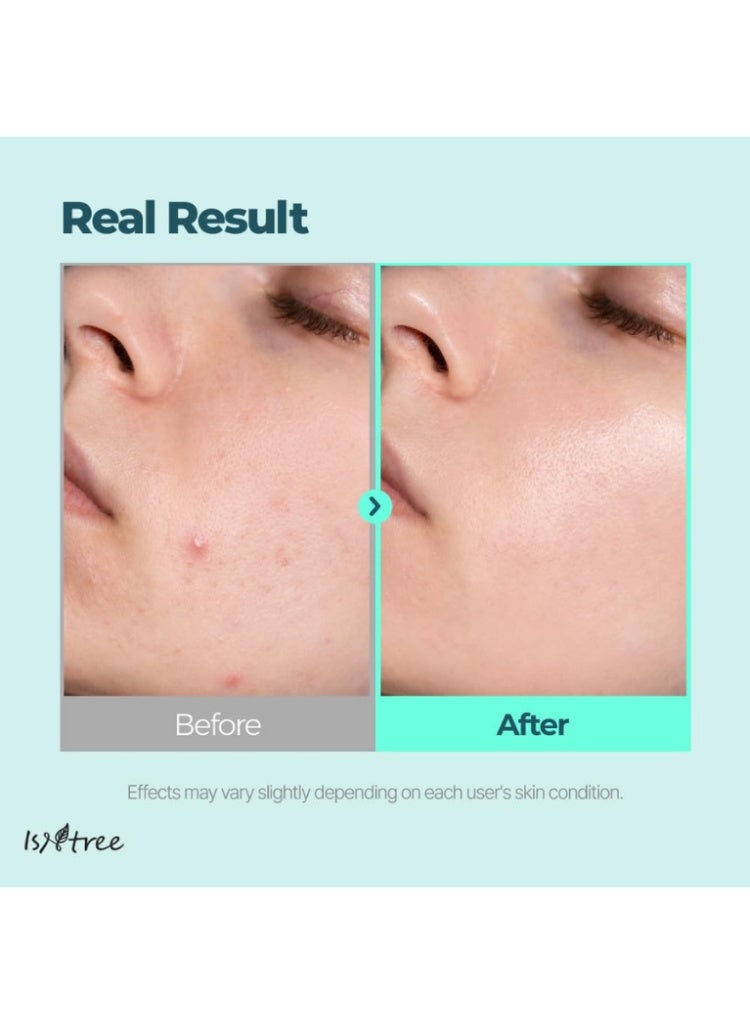 ISNTREE Gim PDRN Deep Sleep Mask for Damaged, Dull & Dehydrated Skin (Hydration + Barrier Recovery) - Image 3