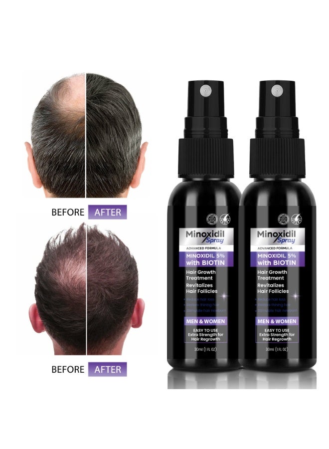 minoxidil spray Advanced Minoxidil 5% with Biotin Hair Growth Spray,  Nourishes Follicles, Reduces Hair Loss, Unisex Scalp Care Spray 30ml x 2 Bottles - Image 4