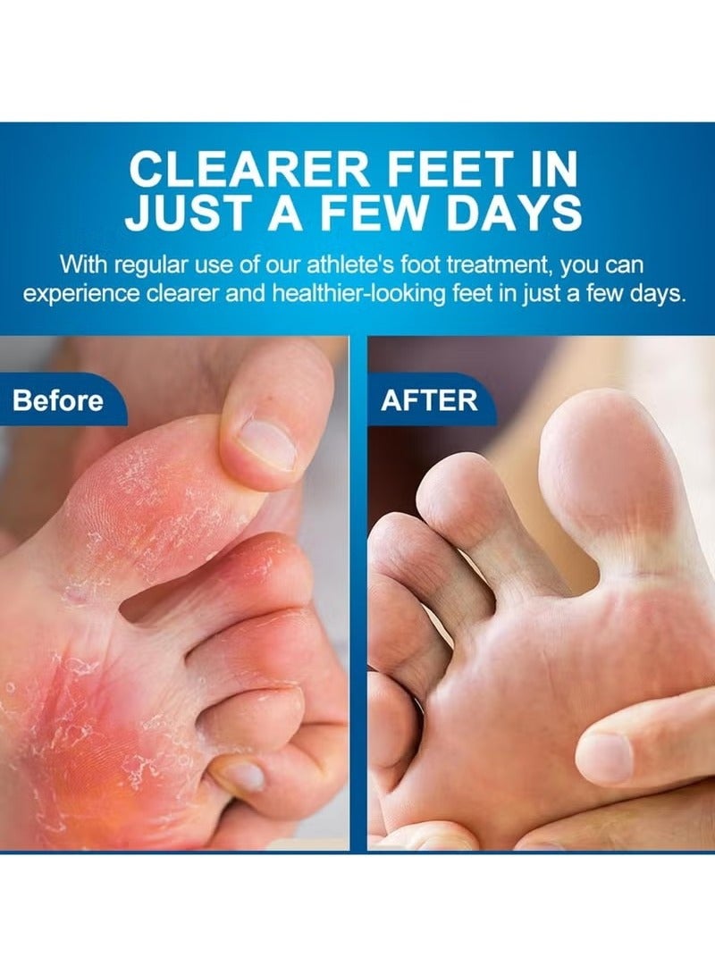سوميفون حكة إصبع القدم خياطة كريم - 20 جرام كريم العناية بالقدم لتخفيف الفطريات ، ترطيب و حكة على الجلد الجاف ، وتخفيف آلام القدم وغيرها من تهيج الجلد - Image 4