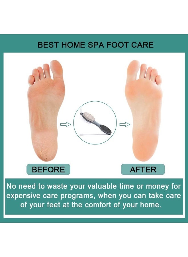 MJZ Foot File Callus Remover - Multi Purpose 4 in 1 Feet Pedicure Tools with Foot Scrubber, Pumice Stone, Pedicure Foot File, Foot Rasp and Sand Paper for Home Foot Care (Grey) - Image 3