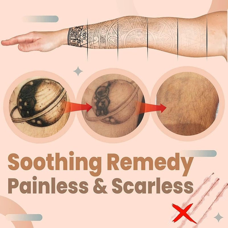 RADIONICS Permanent Tattoo Removal Cream Natural Fades Away Maximum Strength 13G - Image 5
