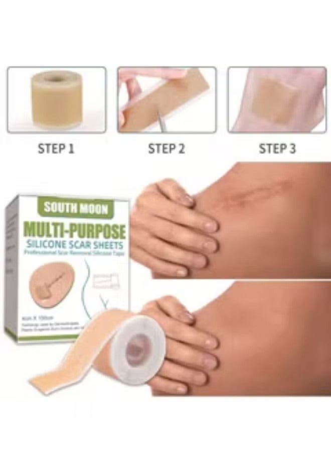 ساوث مون ندبة سيليكون التصحيح تتلاشى الندوب إزالة ندبة مستحضرات التجميل الفعالة للعملية القيصرية ندبات الحروق والندوب الأخرى التي خلفتها لفة شريط جل غير مؤلمة (4 سم × 1.5 م) - Image 1