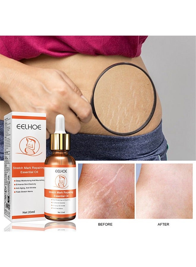 EELHOE Stretch Marks Repairing Essential Oil, Stretch Marks And Scar Removal Oil For Pregnancy Stretch Marks Scar Belly Oil, For Wrinkles Obesity Stretch Mark Moisturizing Remove Marks 20ML - Image 2