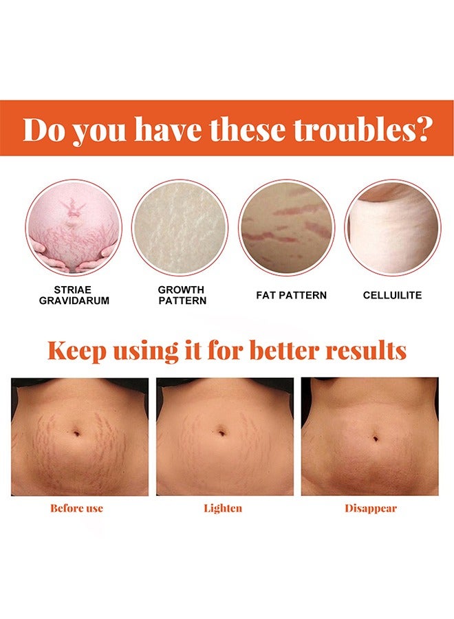 EELHOE Stretch Marks Repairing Essential Oil, Stretch Marks And Scar Removal Oil For Pregnancy Stretch Marks Scar Belly Oil, For Wrinkles Obesity Stretch Mark Moisturizing Remove Marks 20ML - Image 4