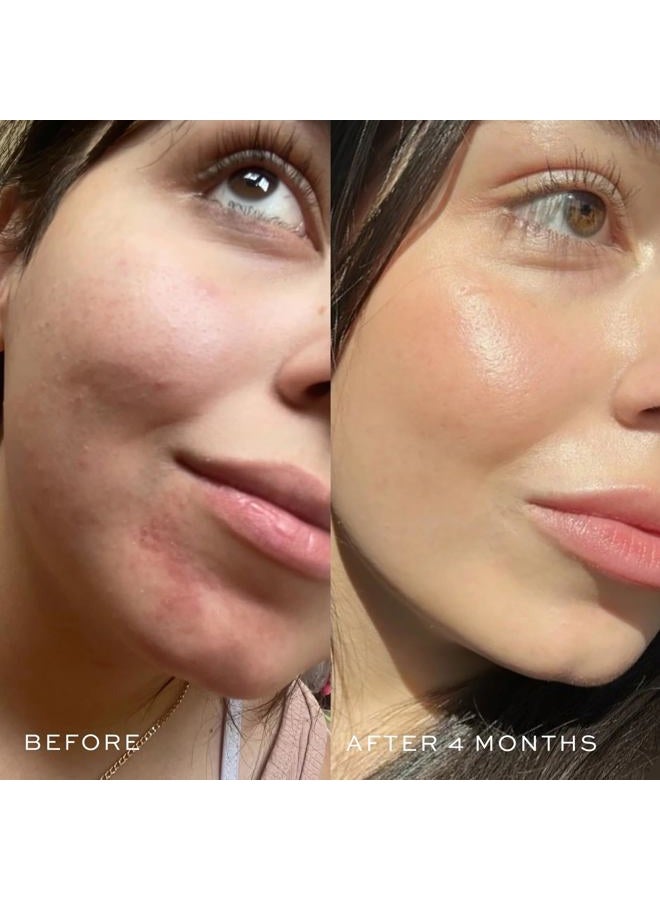 DIME Beauty Blue Facial Oil, 1 oz / 30 mL - Blemish Spot Treatment with Blue Tansy, Black Cumin Seed, Rosehip, and Grapeseed Oils - Image 3