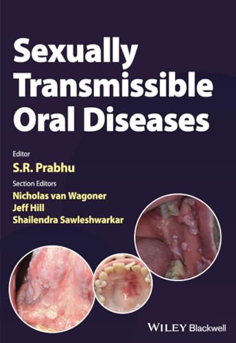 Sexually Transmissible Oral Diseases 