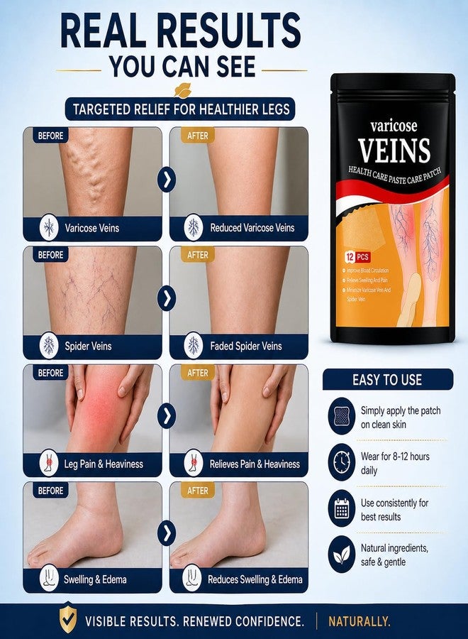 GOXIN Varicose Veins Relief Patches - Reduces Swelling, Relieves Pain, Improves Blood Circulation & Vein Health | Herbal, Skin-Friendly & Instant Pain Relief - Image 3