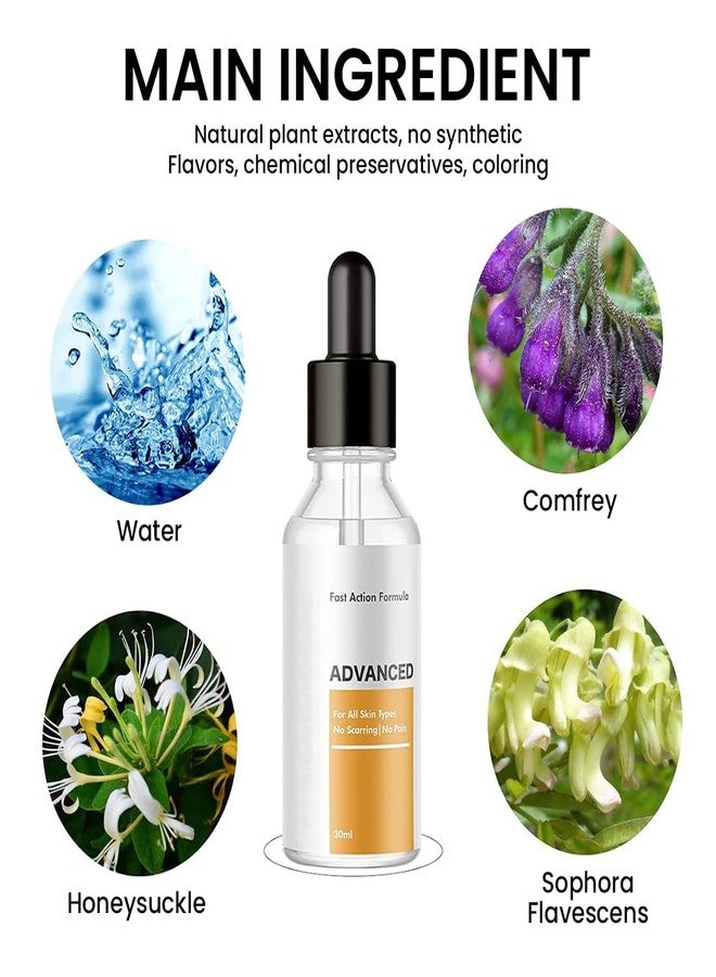 Mullica®Skin Tag & Mole Remover Serum - Quick-Acting Natural Formula for Face and Body - Simple to Use, 30ML - Image 2