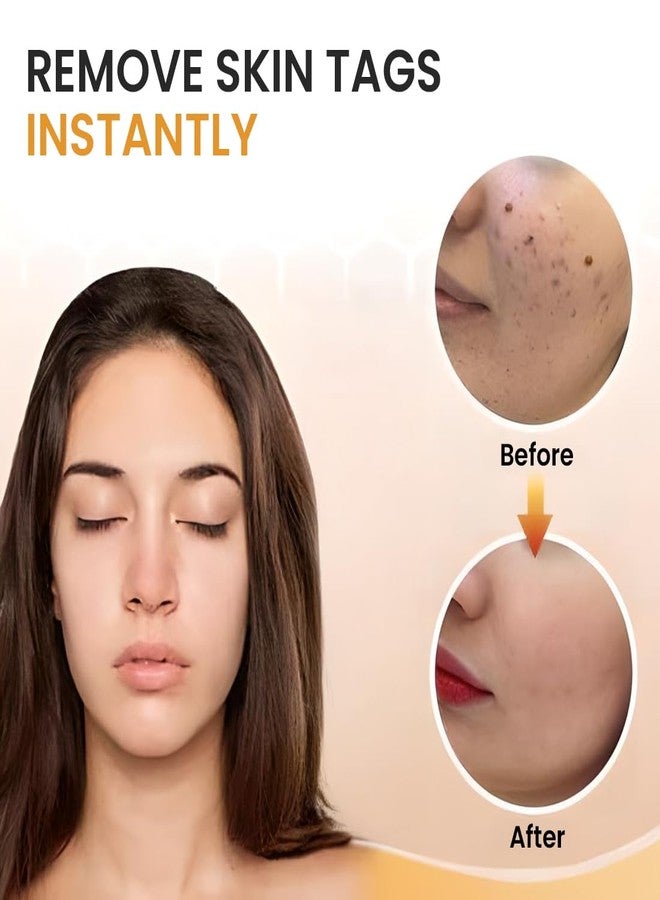 Mullica®Skin Tag & Mole Remover Serum - Quick-Acting Natural Formula for Face and Body - Simple to Use, 30ML - Image 4