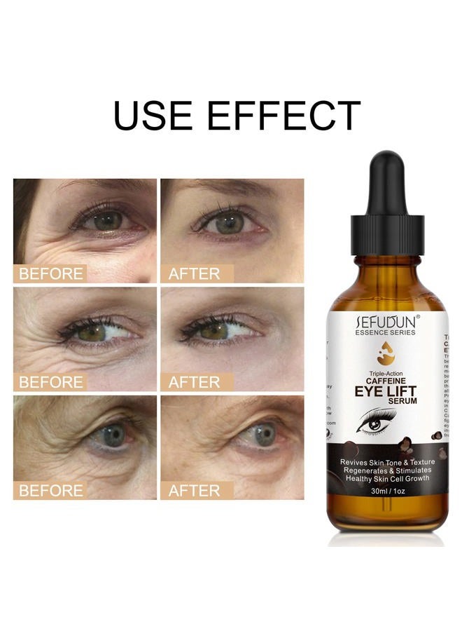 Sefudun Caffeine Eye Serum, Eye Serum Anti Aging Wrinkles Effectively Fades Dark Circles, Eye Bags, Helping to Minimize Wrinkles and Fine Lines, Eliminate Puffiness, with EGCG, Vitamin C Under Eye Serum 30ml - Image 4