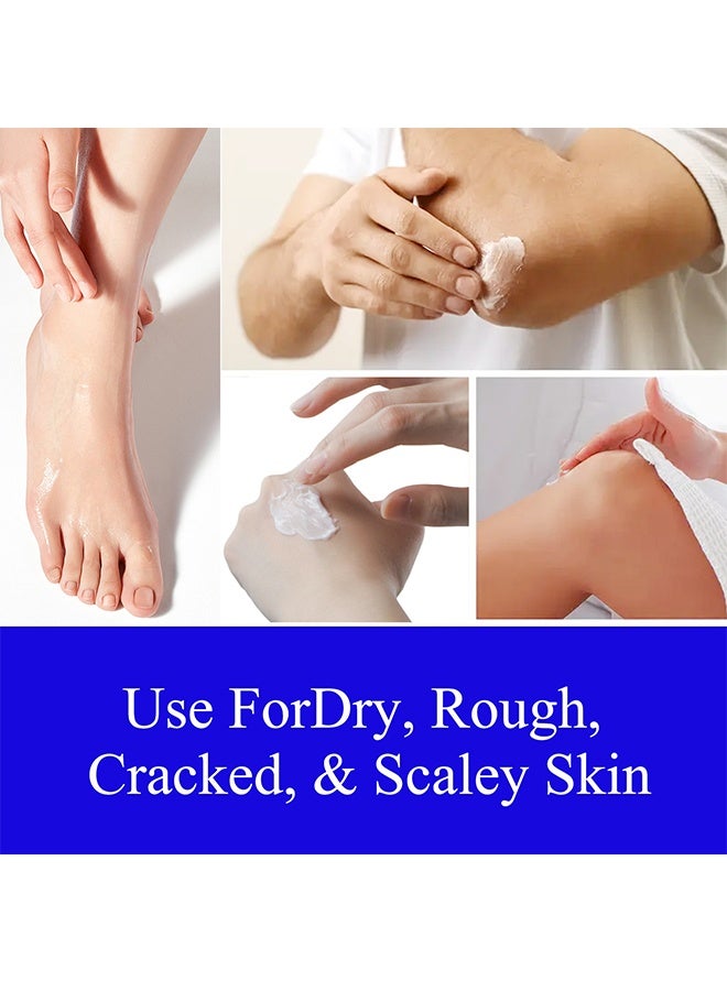 YURHERSU 40٪ كريم اليوريا 2٪ حمض الساليسيليك ، مزيل الكالس كريم اليدين كريم القدم للقدمين الجافة المتشققة واليدين والمرفقين والركبتين ، يرطب وينعم البشرة بشكل مكثف ، ويقشر البشرة الميتة - Image 2