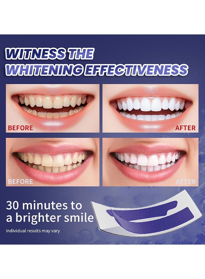 IVISMILE Purple Instant Whitening Strips, V34 Teeth Whitening Strips, Purple Tooth Whitening, Tooth Stain Treatment, Gum Care & Stain Removal, Removes Yellow Stains & Bad Breath, Combining Whitening And Colour Correction 14 Treatments - Image 4