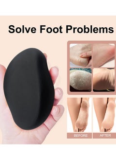 ZGTS Crystal Hair Removal Tool for Men and Women  - Image 3