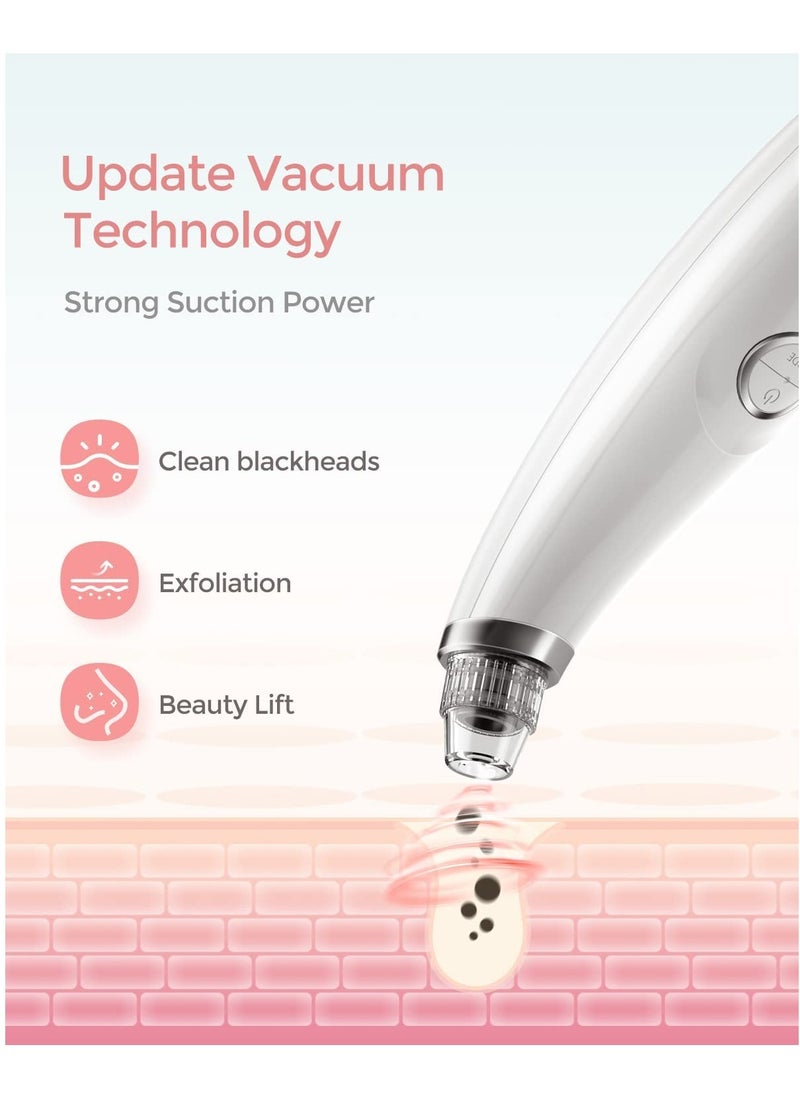 SYOSI - Blackhead Vacuum Remover Acne Remover,Facial Pore Cleanser Electric Acne Comedone, 3 Adjustable Suction Power, USB Rechargeable - Image 1