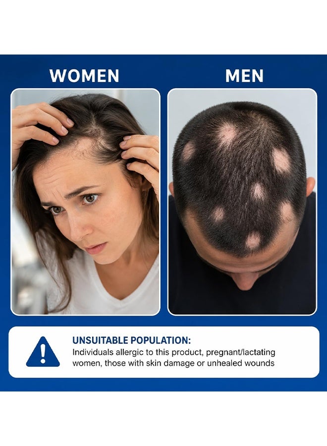 Sumifun Alopecia Hair Growth Spray For Promote Men's Hair Growth, Prevent Hair Loss, Care For Hair, Anti Hair Loss Spray For Thicker Fuller Hair, Scalp Nourishing Butter For Thinning Hair, Intensive Hair Densifying Essence, 30ml - Image 4