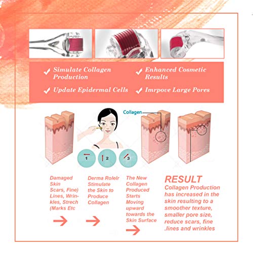 Epyz Transparant Derma Roller With 540 Titanium Alloy Needles (0.5mm, Pink) - Image 3