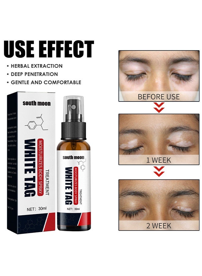 ساوث مون وايت تاغ - علاج البقع البيضاء يرطب رذاذ الجسم ، رذاذ إصلاح الجلد ، يعزز تعافي الميلانين ، يقلل من البقع البيضاء على الجلد ويحسن تصبغ الجلد ، بخاخ العناية بالبهاق 30 مل - Image 2