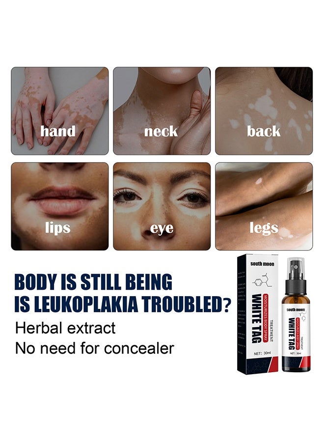 ساوث مون وايت تاغ - علاج البقع البيضاء يرطب رذاذ الجسم ، رذاذ إصلاح الجلد ، يعزز تعافي الميلانين ، يقلل من البقع البيضاء على الجلد ويحسن تصبغ الجلد ، بخاخ العناية بالبهاق 30 مل - Image 5