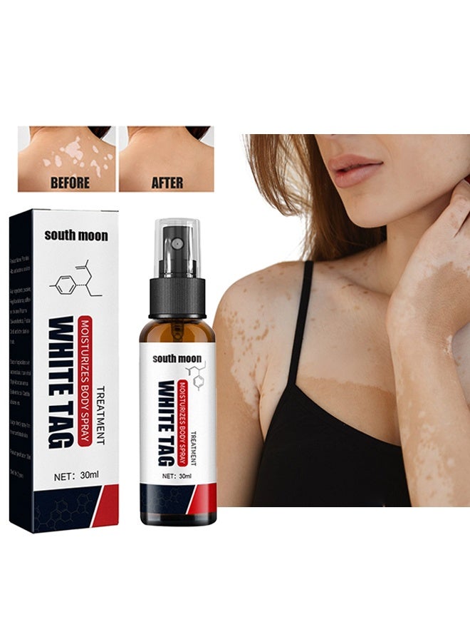 ساوث مون وايت تاغ - علاج البقع البيضاء يرطب رذاذ الجسم ، رذاذ إصلاح الجلد ، يعزز تعافي الميلانين ، يقلل من البقع البيضاء على الجلد ويحسن تصبغ الجلد ، بخاخ العناية بالبهاق 30 مل - Image 1