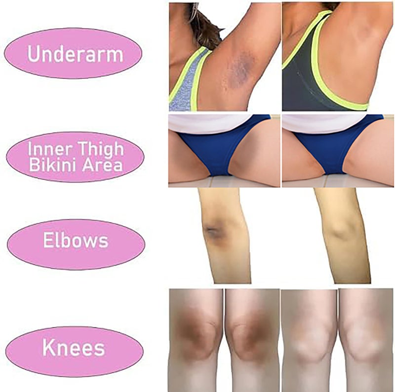 Ceavo Skin Lightening Cream For Dark Intimate Areas, Private Parts, Underarm, Knees, Elbows, Inner Thigh, Bikini Area, Armpit Bleaching Whitening Cream No Rebound (1.06, Floral Fragrance) - Image 5