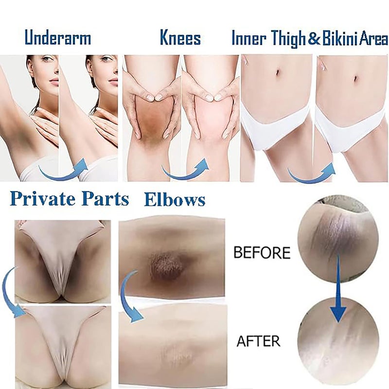 Ceavo Skin Lightening Cream For Dark Intimate Areas, Private Parts, Underarm, Knees, Elbows, Inner Thigh, Bikini Area, Armpit Bleaching Whitening Cream No Rebound (1.06, Floral Fragrance) - Image 2
