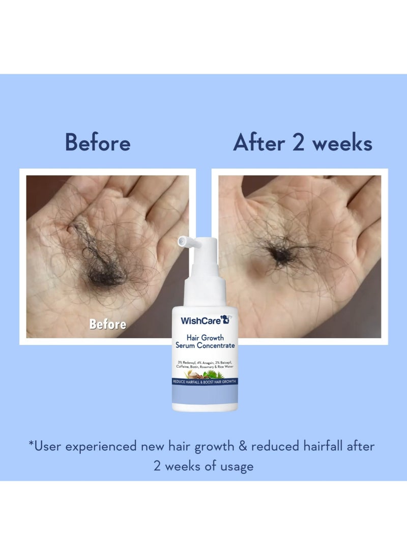 WishCare مصل مركز لنمو الشعر - 3% ريدينسيل، 4% أناجين، 2% بايكابيل، كافيين، بيوتين، كيراتين نباتي وماء الأرز - مصل نمو الشعر للرجال والنساء - Image 4