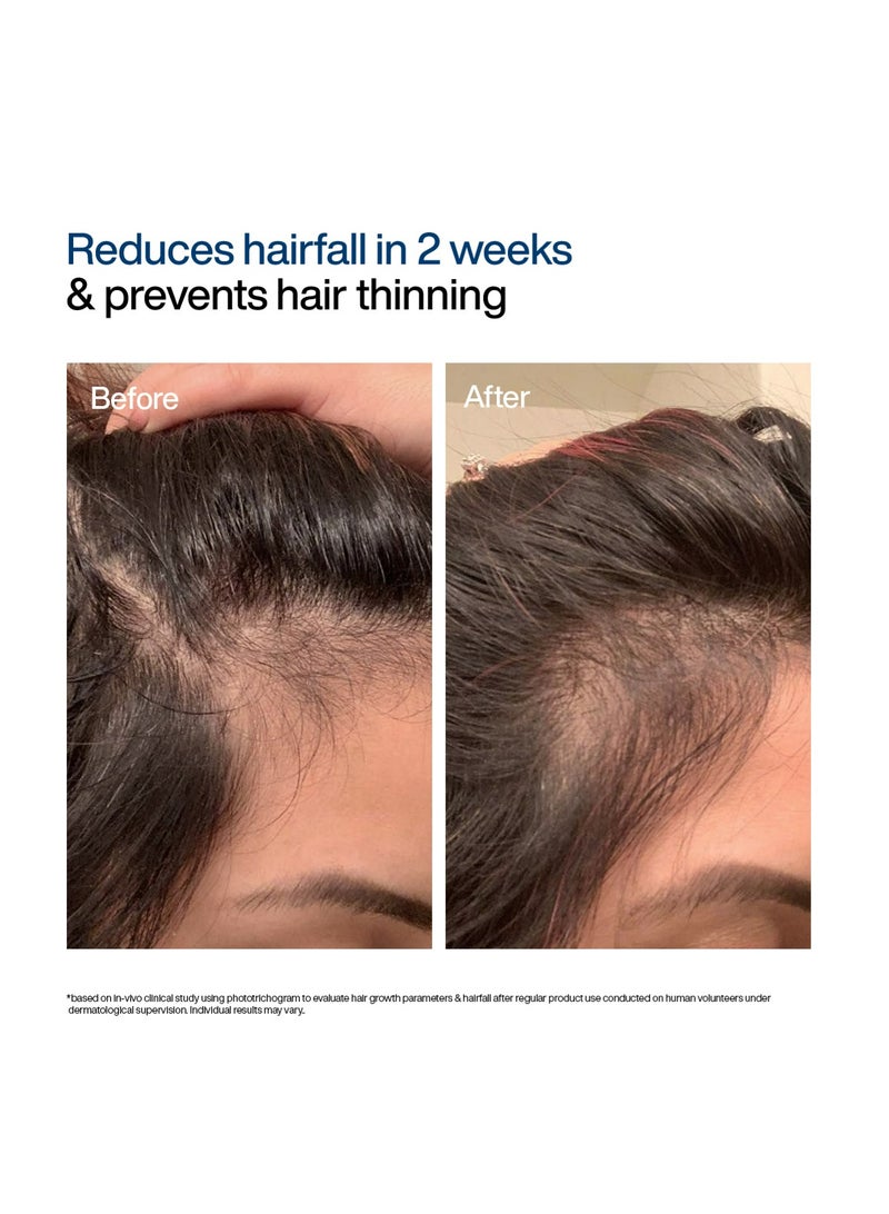 WishCare Hair Growth Serum Concentrate | Redensyl, Anagain, Baicapil, Rosemary, Caffeine, Biotin & Rice Water | Advanced Serum for Scalp | Controls Hairfall & Boosts New Growth | In-Vivo Tested | For Men & Women - Image 4