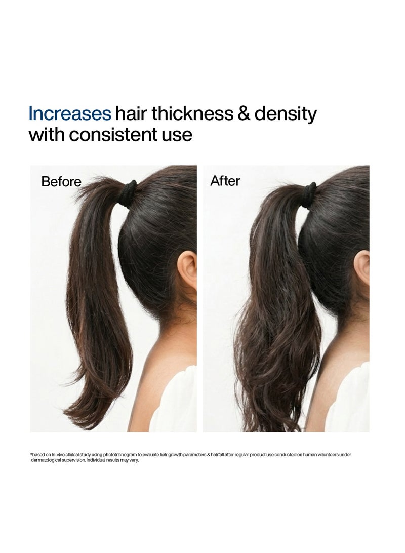 WishCare Hair Growth Serum Concentrate | Redensyl, Anagain, Baicapil, Rosemary, Caffeine, Biotin & Rice Water | Advanced Serum for Scalp | Controls Hairfall & Boosts New Growth | In-Vivo Tested | For Men & Women - Image 5